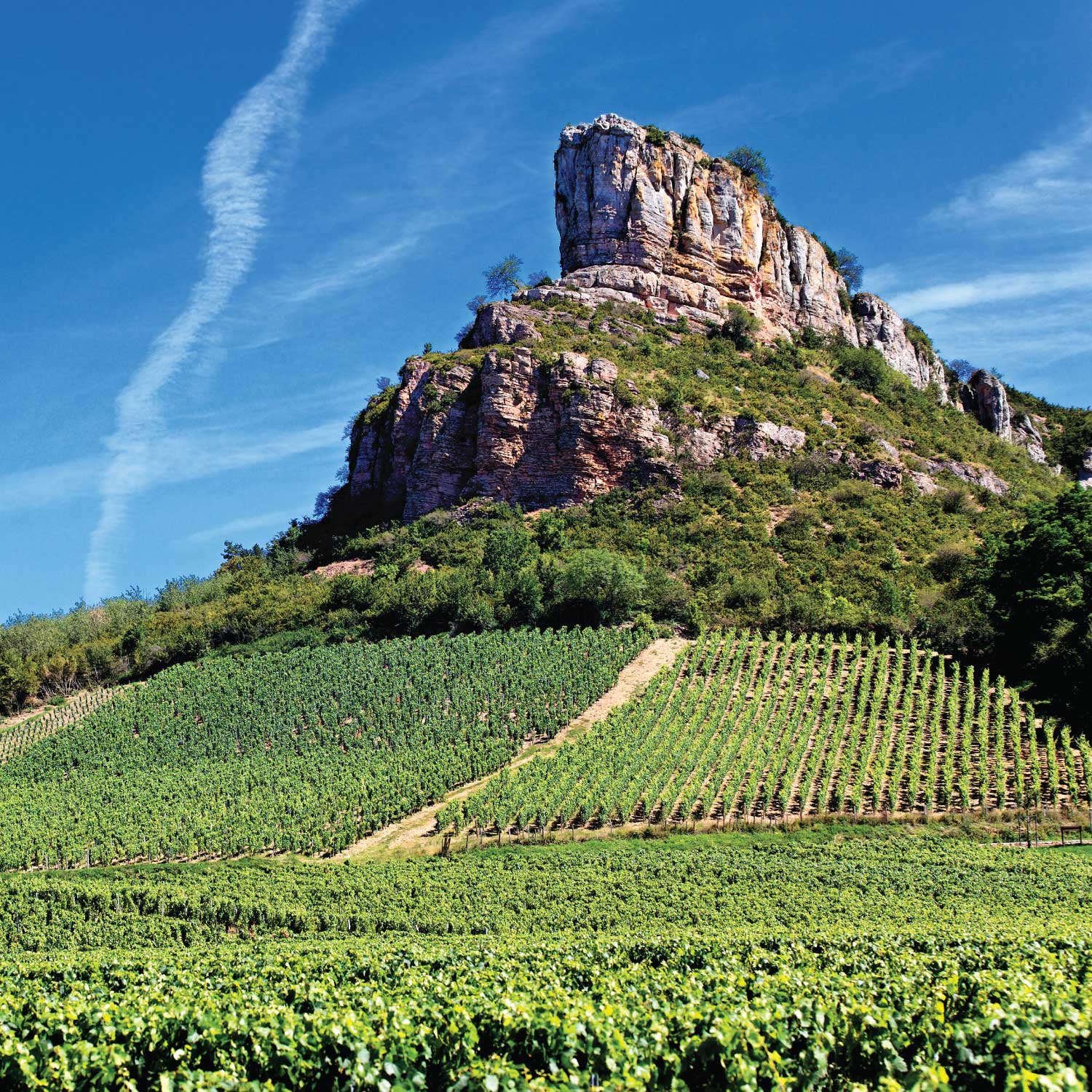 Otosclerosis Argentina